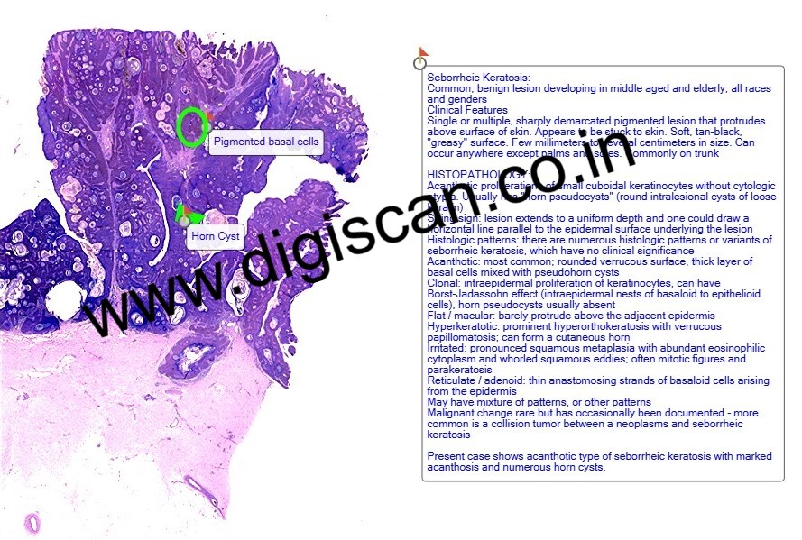 MD Pathology Exam Cases (Digital Slides & Spot Diagnosis Cases)
